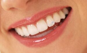 خمیر دندان کلوزآپ دیاموند