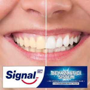 خمیر دندان سیگنال سفید کننده